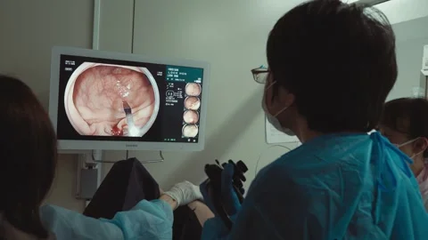 Endoscope Surgery Stock Footage 307477007