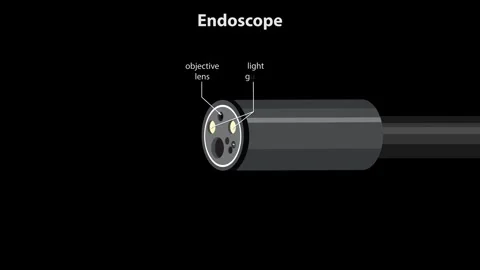 Endoscope Tip Components and Function Animation on Black Background Stock Footage 316588093
