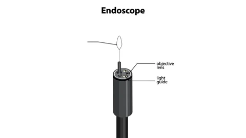 Endoscope Tip Components Labeled in Animated Technical Diagram Stock Footage 320095145