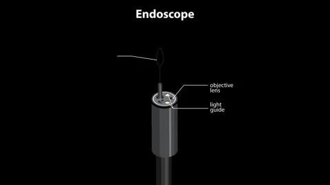Endoscope Tip Components Labeled in Rotating 3D Animation Stock Footage 316588251