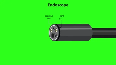 Endoscope Tip Diagram Animation With Labeled Components and Snare Deployment Stock Footage 316019596