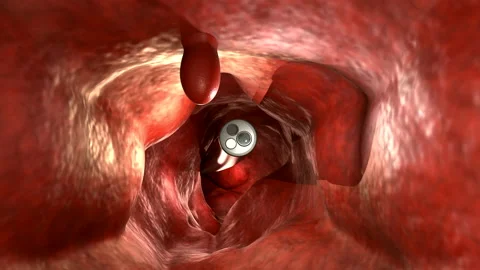 Endoscope01 스톡 동영상 135562249