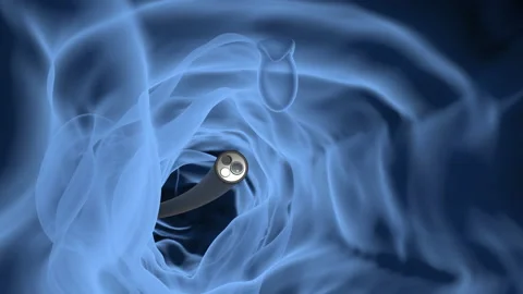 Endoscope08 Stock Footage 143128951