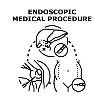 Endoscopic medical procedure using modern surgery tools 스톡 일러스트