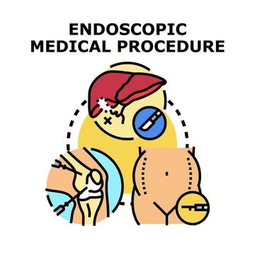 Endoscopic medical procedure using modern surgery tools Stock Illustration