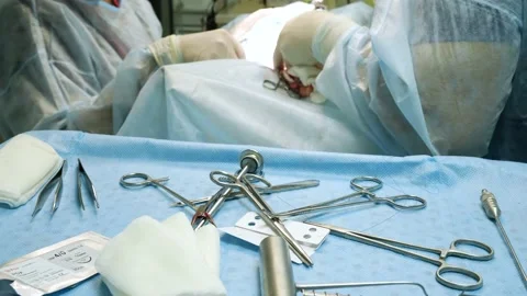 An endoscopic operation is in progress On the table in front of the doctors are 動画素材 218209794