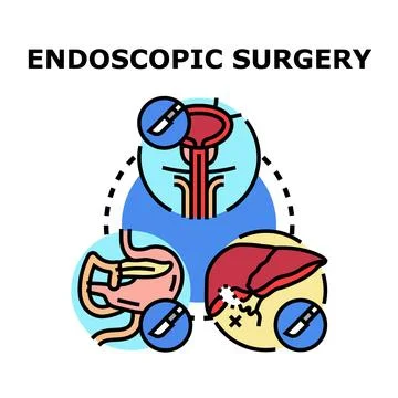 Endoscopic surgery concept with internal organs medical procedure Stock Illustration