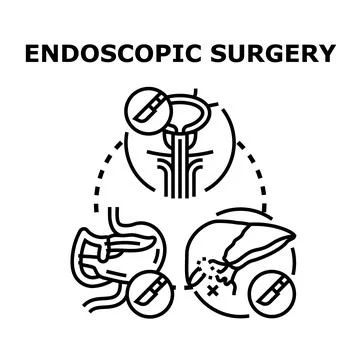 Endoscopic surgery concept with internal organs medical procedure Stock Illustration
