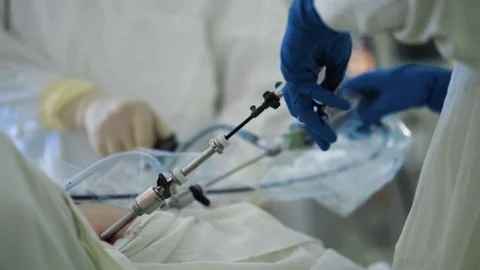 Endoscopic surgery Video stock 74457662
