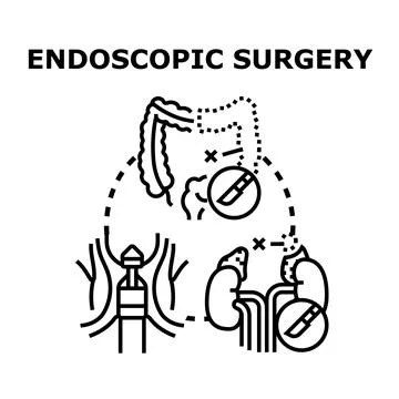 Endoscopic surgery medical procedure concept development Stock Illustration