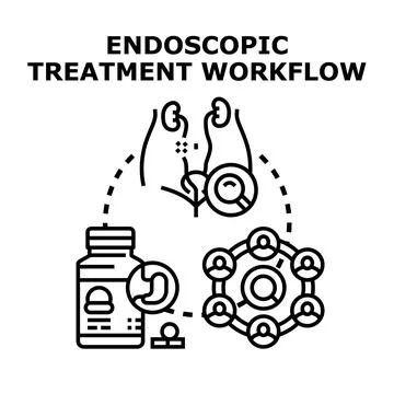 Endoscopic treatment workflow diagram vector concept 스톡 일러스트