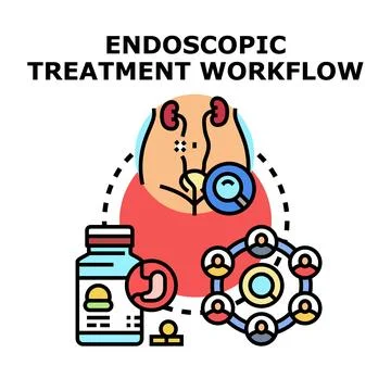 Endoscopic treatment workflow diagram vector concept 스톡 일러스트