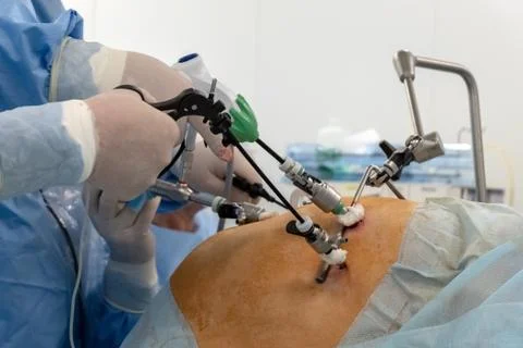 Endoscopy. Doctors use endo-instruments and video cameras to perform surgery  Stock Photos