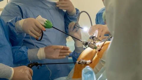 Endoscopy, laparoscopy, surgery. Operating room in a hospital. The team of su Stock Photos