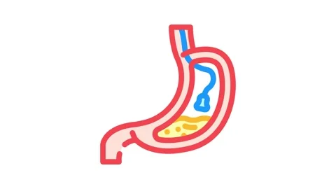 Endoscopy surgery color icon animation Stock Footage 327261750