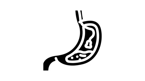Endoscopy surgery glyph icon animation Stock Footage 326738266