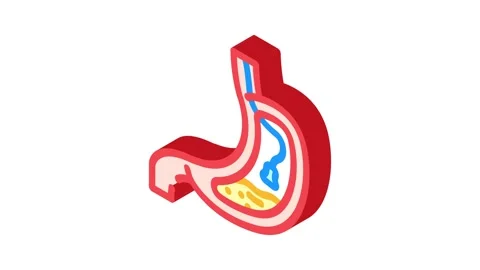 Endoscopy surgery isometric icon animation Stock Footage 327283141