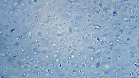 Energetic movement of large number of sperm in the semen fluid under microscope Stock Footage 330857793