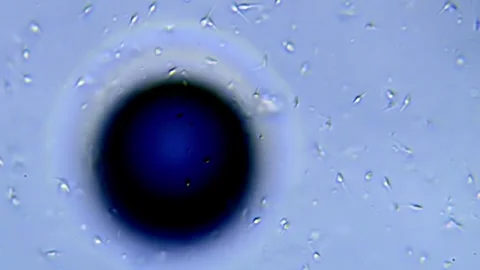 Energetic movement of large number of sperm in the semen fluid under microscope Stock Footage 330857912