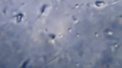 Energetic movement of large number of sperm in the semen fluid under microscope Stock Footage 330858028
