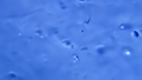 Energetic movement of large number of sperm in the semen fluid under microscope Stock Footage 330858307