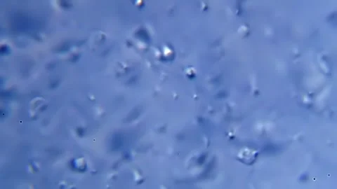 Energetic movement of large number of sperm in the semen fluid under microscope Stock Footage 330883143