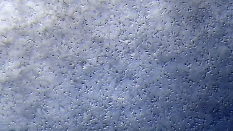 Energetic movement of large number of sperm in the semen fluid under microscope Stock Footage 330883190