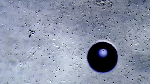 Energetic movement of large number of sperm in the semen fluid under microscope Stock Footage 330883261