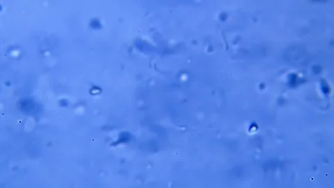 Energetic movement of large number of sperm in the semen fluid under microscope 库存影片 330887055