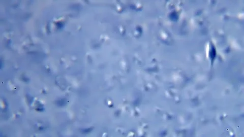 Energetic movement of large number of sperm in the semen fluid under microscope Stock Footage 330887058