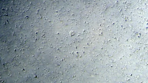 Energetic movement of large number of sperm in the semen fluid under microscope Stock Footage 330887072