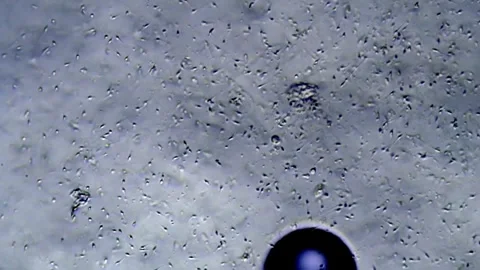 Energetic movement of large number of sperm in the semen fluid under microscope Stock Footage 330887104