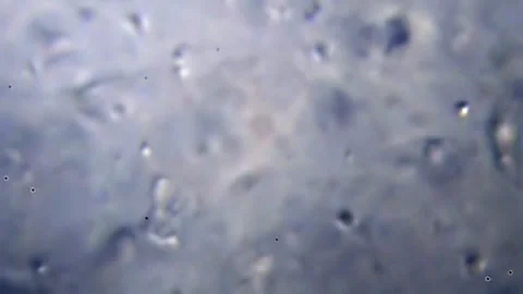 Energetic movement of large number of sperm in the semen fluid under microscope Stock Footage 330891377