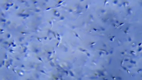Energetic movement of large number of sperm in the semen fluid under microscope Vidéo 330893199
