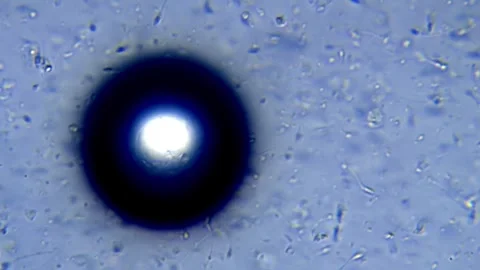Energetic movement of large number of sperm in the semen fluid under microscope Stock Footage 330898571