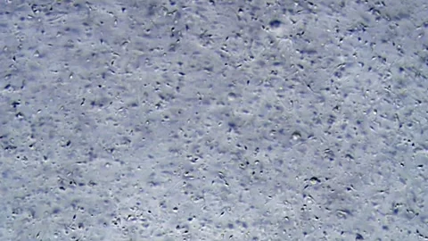 Energetic movement of large number of sperm in the semen fluid under microscope Stock Footage 330898576