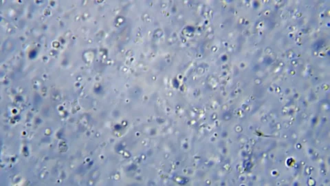 Energetic movement of large number of sperm in the semen fluid under microscope Stock Footage 330899384