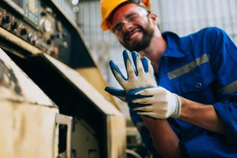 Engineer worker with accident at factory Foto stock