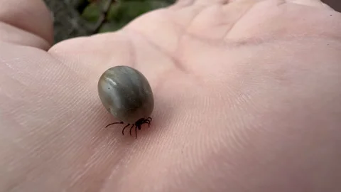 Engorged Tick Crawling Macro Close Up on Human Skin Parasite Infection Risk Conc Stock Footage 332944332