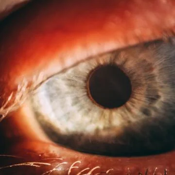 Enlarged image of an eye iris made with a slit lamp Stock Photos