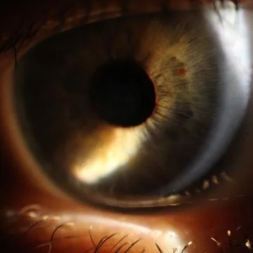 Enlarged image of an eye iris made with a slit lamp Stock Photos