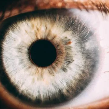 Enlarged image of an eye iris made with a slit lamp Stock Photos