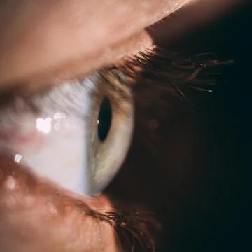 Enlarged image of an eye iris made with a slit lamp Stock Photos