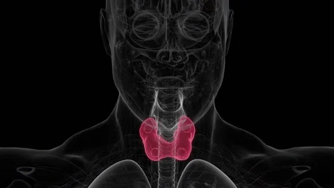 An enlarged parathyroid gland is an abnormal increase in the size of one or Stock Footage 345125579