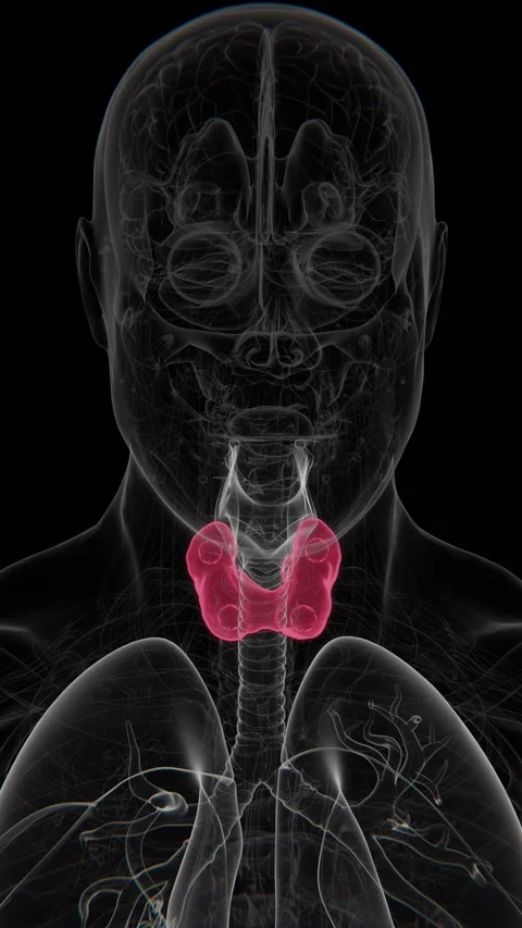 An enlarged parathyroid gland is an abnormal increase in the size of one or Stock Footage 345125600