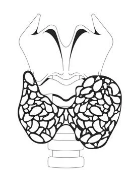 Enlarged thyroid gland affected by hyperthyroidism outline illustration Illustrazione stock