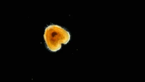 Entoprocta larva under a microscope, a t... | Stock Video | Pond5