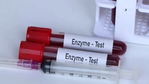 Enzyme test, blood sample to analyze in the laboratory Stock Footage 239507757