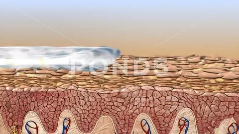 The epidermis is the outer layer of the skin defined as a stratified ...