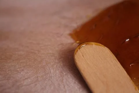 Epilation of the bikini area. Close-up of liquid wax hair removal. Shugaring Stock Photos